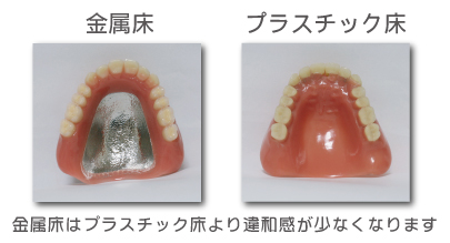 驥大ｱ槫ｺ翫→繝励Λ繧ｹ繝√ャ繧ｯ蠎・ width=